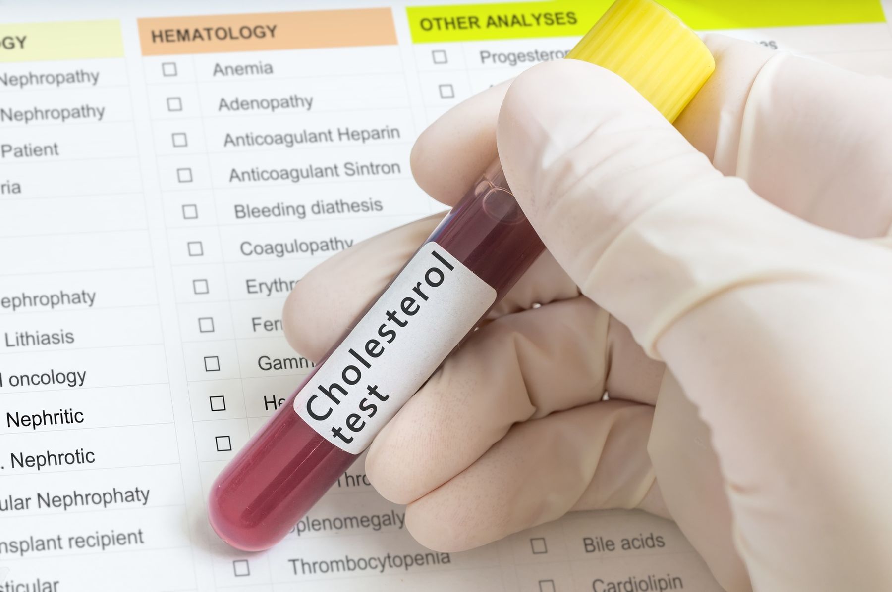 lipidogram, cholesterol